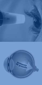 banner_glaucoma banner_glaucoma