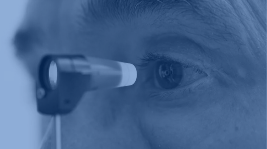 El glaucoma: una enfermedad silenciosa en la que la detección temprana es fundamenta imagen